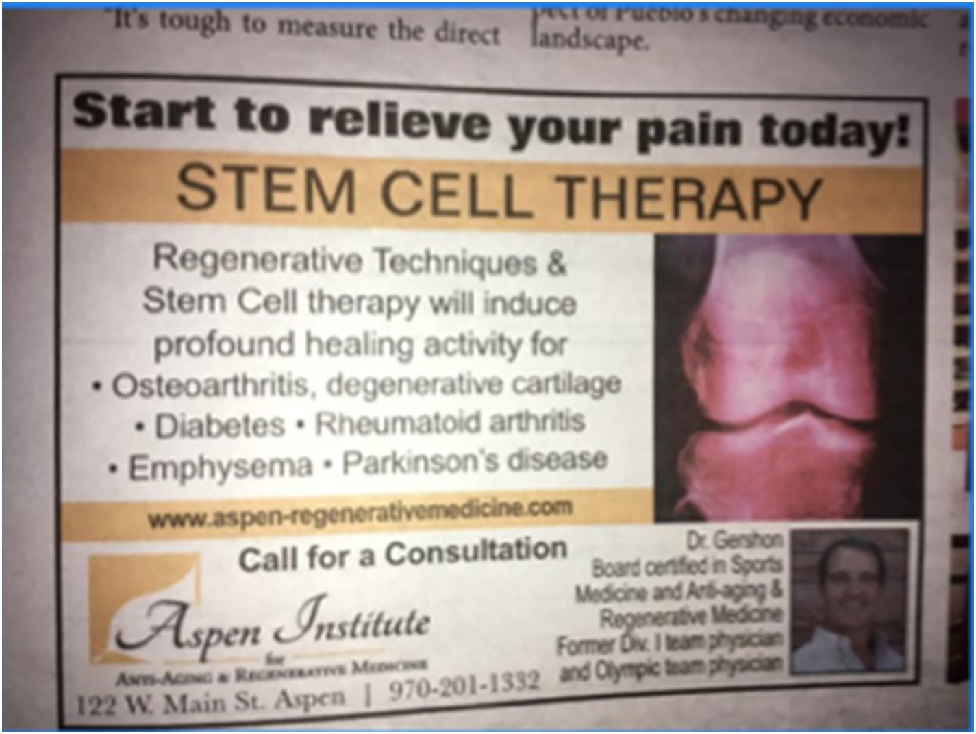 間充質(zhì)干細胞治療1型糖尿病臨床應(yīng)用案例