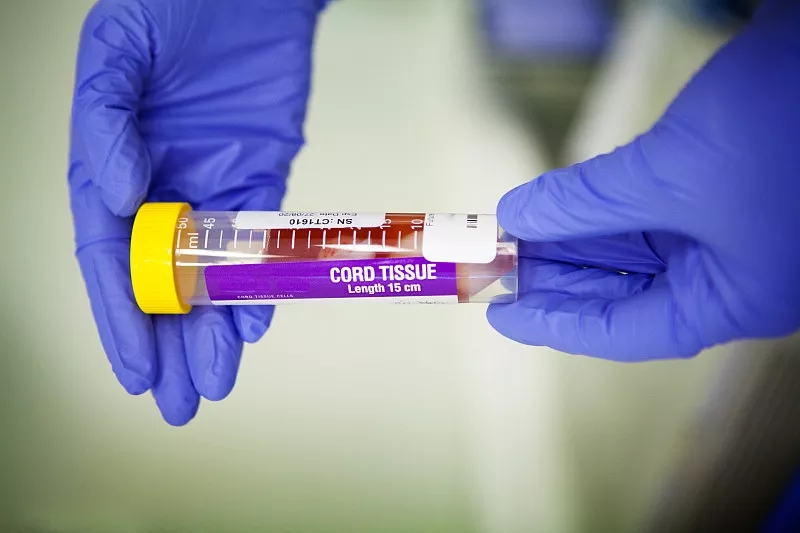 間充質干細胞的優點有哪些？