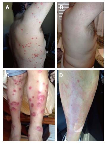 圖 2 患者軀干和腿部圖像 圖 2 患者軀干和腿部圖像