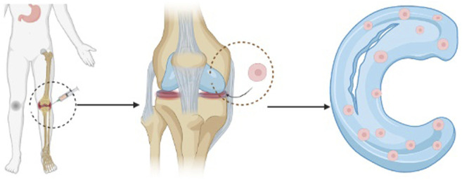 圖1：干細(xì)胞注射方法的過程示意圖。