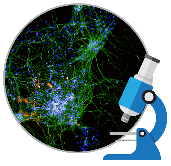 干細(xì)胞能治療好阿爾茨海默癥嗎?
