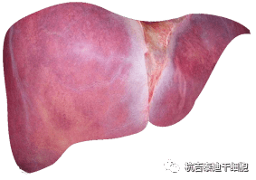 干細胞如何治療慢性肝病? 干細胞如何治療慢性肝病?