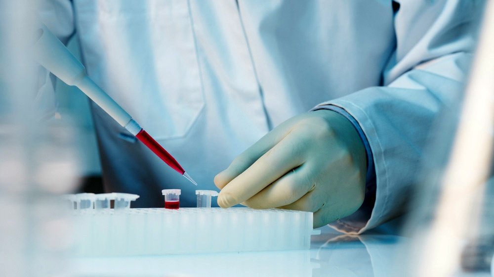 什么是干細胞移植-干細胞移植的流程和優勢 什么是干細胞移植-干細胞移植的流程和優勢