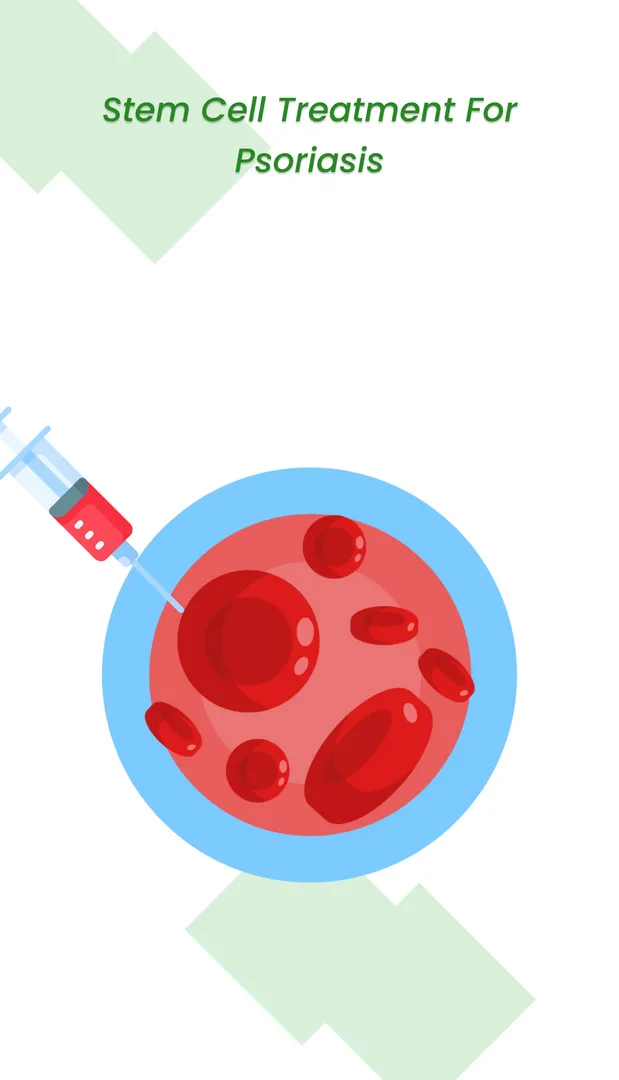 干細胞治療牛皮癬 干細胞治療牛皮癬