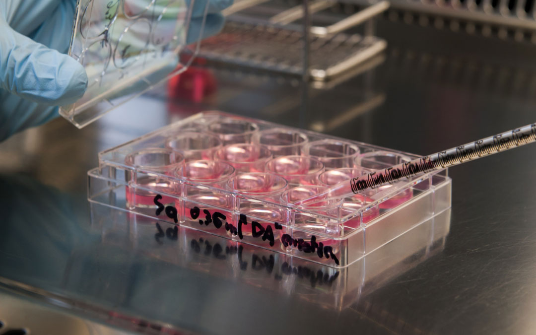 踝關節(jié)疼痛的干細胞療法 踝關節(jié)疼痛的干細胞療法