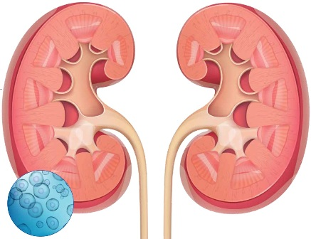 都有哪些干細胞類型應用到腎臟疾病當中？