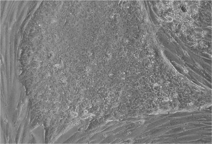 胚胎干細胞移植的來源 胚胎干細胞移植的來源