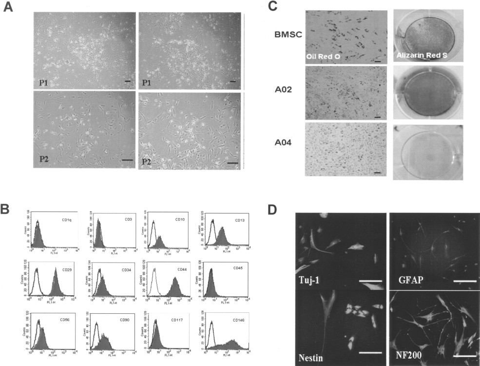 圖2:源自人子宮內膜息肉 (EPMSC) 的MSC 圖2:源自人子宮內膜息肉 (EPMSC) 的MSC