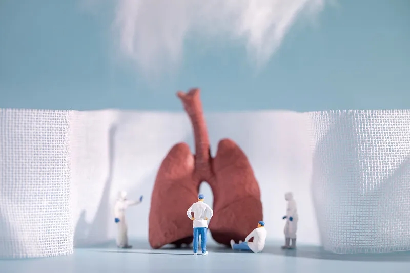 慢性阻塞性肺病(COPD)的四個階段 慢性阻塞性肺病(COPD)的四個階段