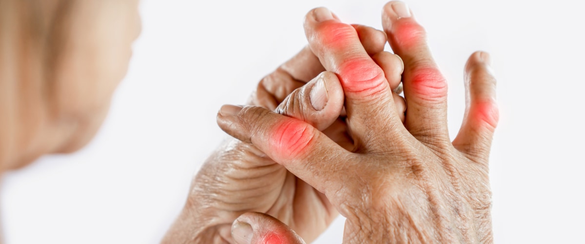 間充質干細胞治療全身性風濕病的臨床研究進展