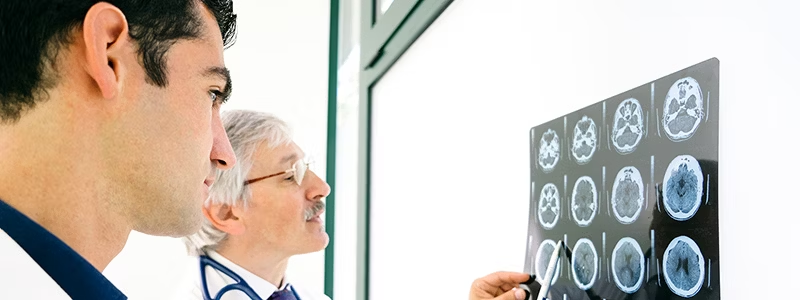 中風期間會發生什么？癥狀、后果和治療方案是什么？