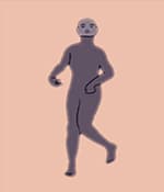 運動障礙型腦癱涉及過度的不自主運動。
運動障礙性腦癱的類型
肌張力障礙：僵硬和松弛交替出現，
舞蹈徐徐樣腦癱：持續的不自主運動導致姿勢異常。