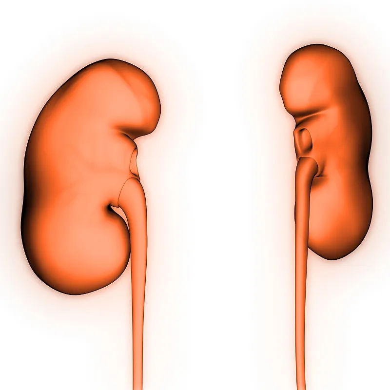 IgA腎?。喊Y狀-病因-診斷-飲食等