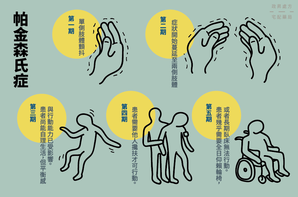 神經(jīng)干細(xì)胞移植管理帕金森?。禾魬?zhàn)、納米技術(shù)支持和前景