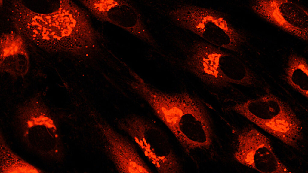 間充質干細胞衍生療法和外泌體作為先進療法的后起之秀 間充質干細胞衍生療法和外泌體作為先進療法的后起之秀