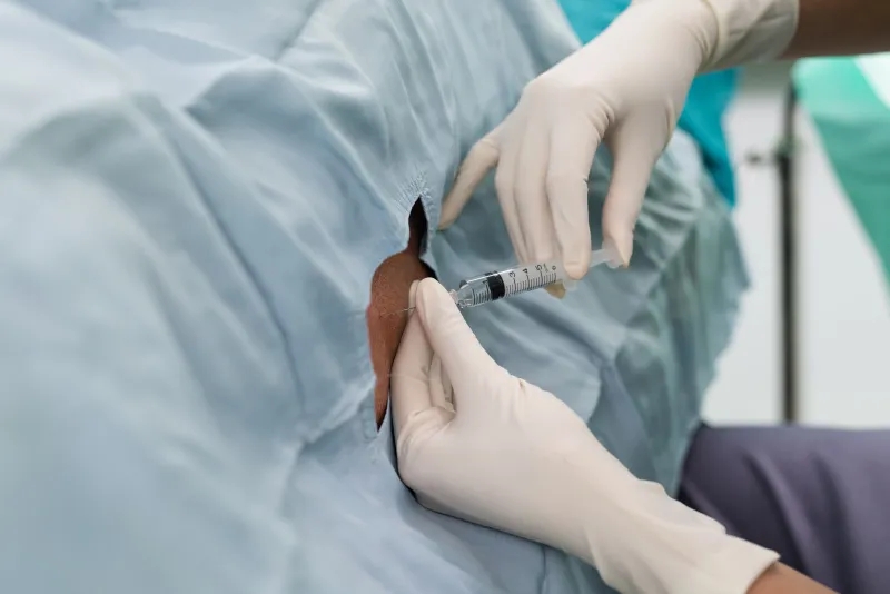 干細胞,-鞘內給藥,-神經系統疾病