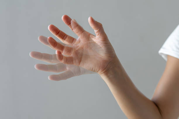 患者接受胚胎干細胞治療帕金森病的可行性研究