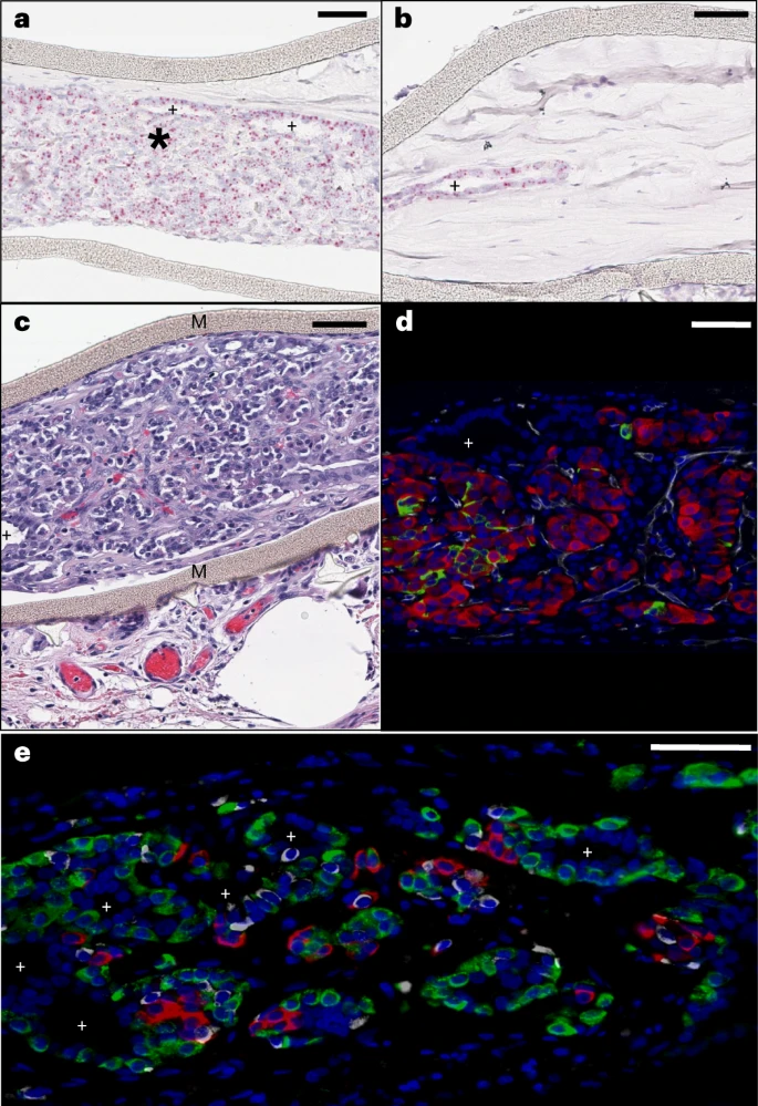 圖3：植入后第6個月時裝置封裝的人類干細胞衍生植入物的成分。