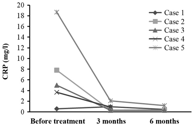 圖4：每位患者治療前后的CRP水平。1名患者的CRP水平降低，而其他4名患者的CRP水平保持穩(wěn)定并在正常范圍內(nèi)。