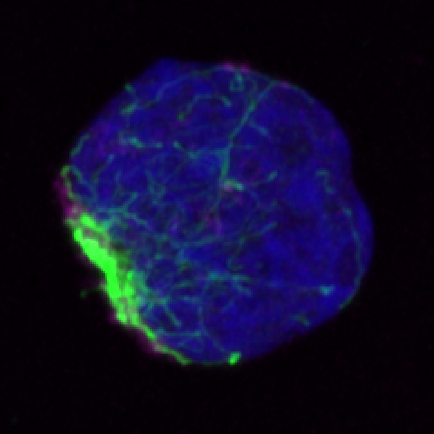 加州大學圣地亞哥分校的科學家發現,錯誤折疊的蛋白質在被處理之前聚集并被限制在干細胞內的單個區域(綠色)中。 加州大學圣地亞哥分校的科學家發現,錯誤折疊的蛋白質在被處理之前聚集并被限制在干細胞內的單個區域(綠色)中。
