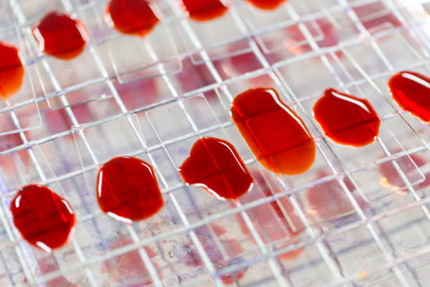 可以用臍帶血干細(xì)胞可以治療哪些疾病? 可以用臍帶血干細(xì)胞可以治療哪些疾病?