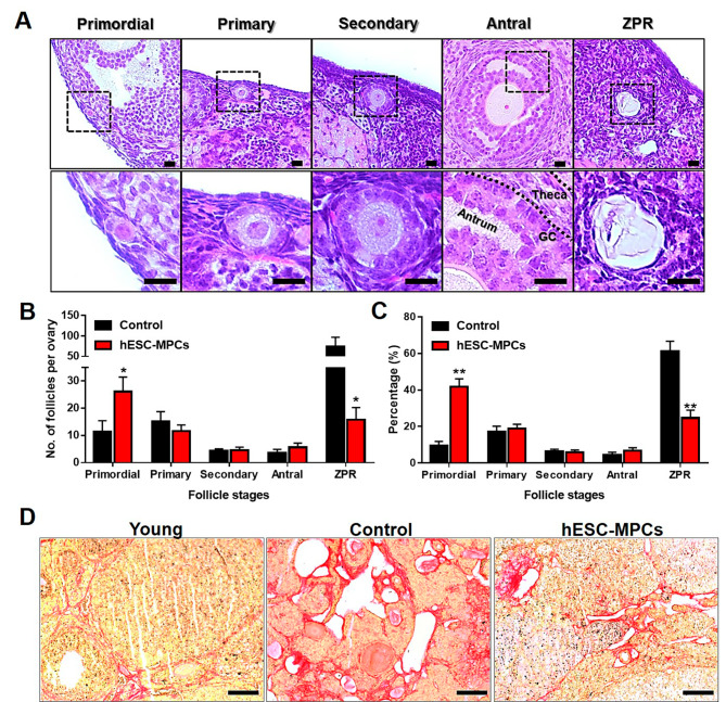 圖3：通過在圍絕經期小鼠中多次引入人胚胎干細胞衍生的間充質祖細胞（hESC-MPC）來維持卵巢儲備。