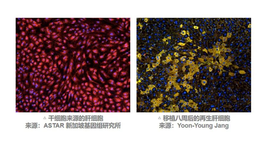 MSC有望通過不同途徑調動肝臟細胞再生來改善預后。