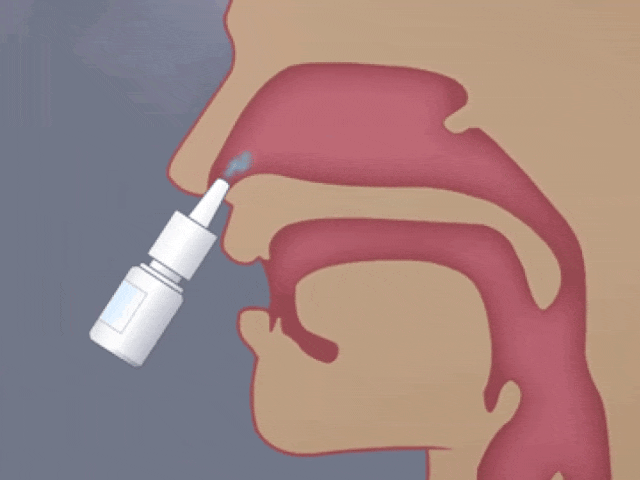 日本居家干細胞噴鼻能治療腦梗死：是科學突破還是商業噱頭？