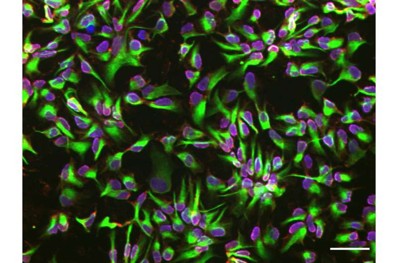 神經干細胞 神經干細胞