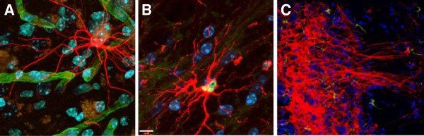 圖3:人類中樞神經系統干細胞 (HuCNS-SC) 根據其遷移位點優先分化為特定譜系。 圖3:人類中樞神經系統干細胞 (HuCNS-SC) 根據其遷移位點優先分化為特定譜系。