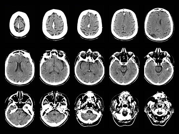 老年神經系統會出現哪些問題？