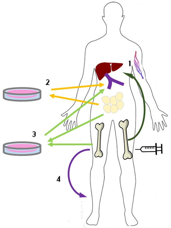 圖1:間充質(zhì)干細胞治療1型糖尿病方法示意圖。 圖1:間充質(zhì)干細胞治療1型糖尿病方法示意圖。