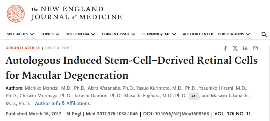 自體誘導干細胞來源的視網膜細胞用于治療黃斑變性 自體誘導干細胞來源的視網膜細胞用于治療黃斑變性