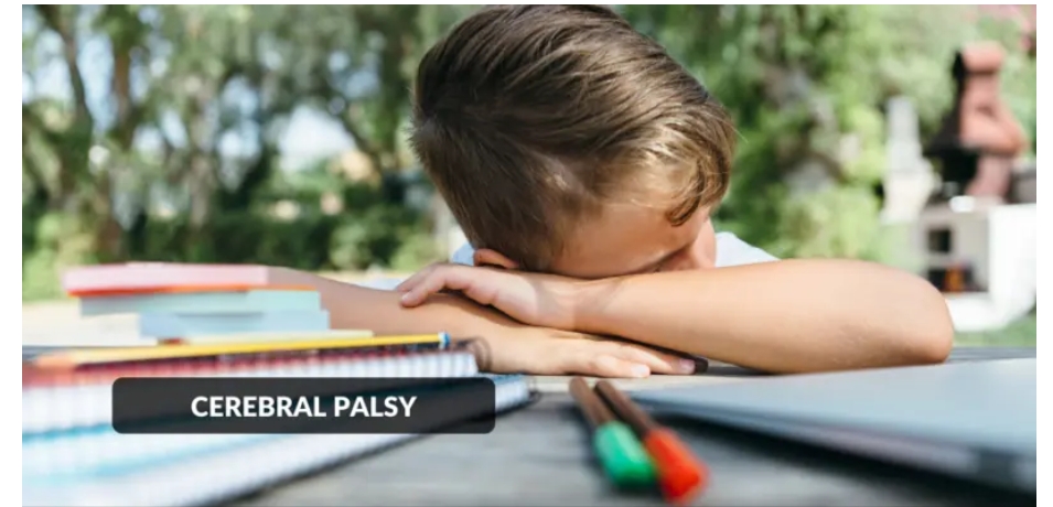 腦癱-原因、癥狀、類(lèi)型和治療方法