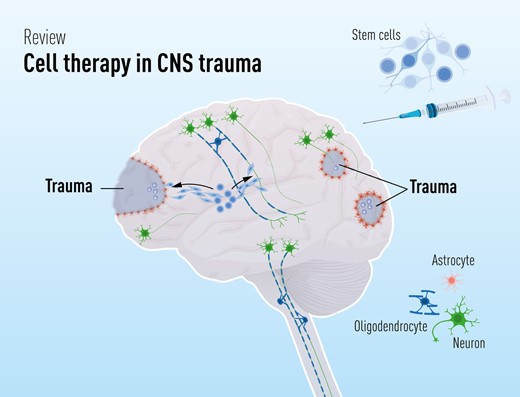 干細胞療法修復中樞神經系統創傷:4個原則—什么、何時、何地和為什么 干細胞療法修復中樞神經系統創傷:4個原則—什么、何時、何地和為什么