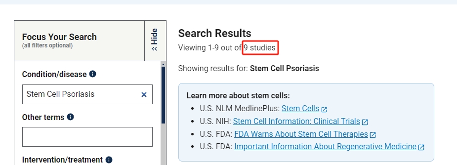 干細(xì)胞治療銀屑病臨床研究項(xiàng)目有9項(xiàng)。其中國(guó)內(nèi)發(fā)布的占據(jù)7項(xiàng)。 干細(xì)胞治療銀屑病臨床研究項(xiàng)目有9項(xiàng)。其中國(guó)內(nèi)發(fā)布的占據(jù)7項(xiàng)。