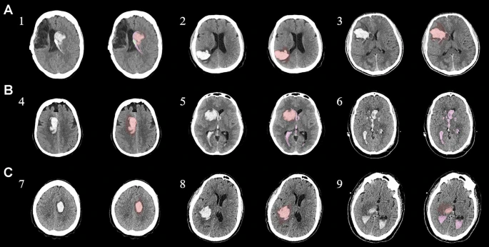 為了描述目的，患者按入組順序被賦予編號，并被連續分配到三組中的一組，每組三名。