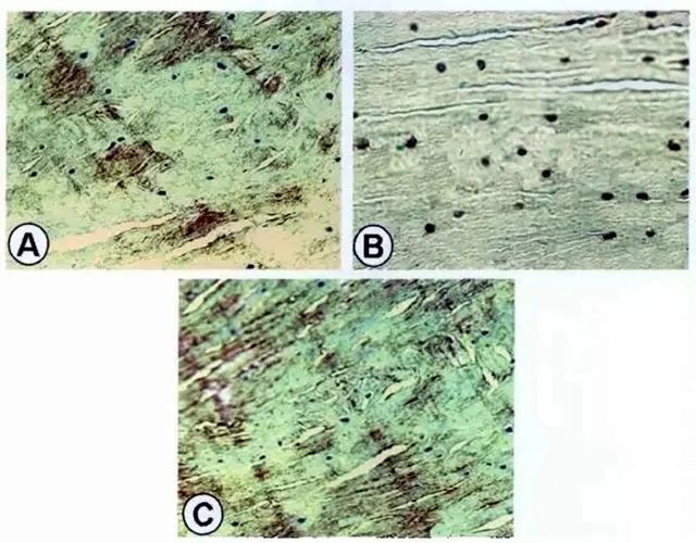 A為紅-紅區(qū)修復(fù)組織II型膠原的表達(dá)；B為紅-紅區(qū)修復(fù)組織S-100蛋白表達(dá)；C為紅-紅區(qū)修復(fù)組織I型膠原表達(dá)。