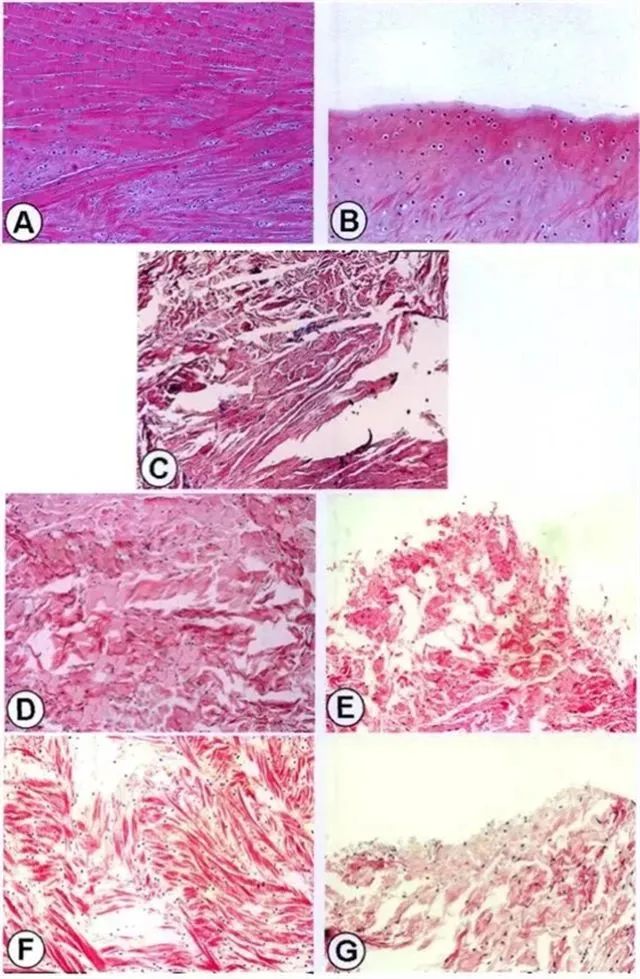 不同時(shí)間點(diǎn)修復(fù)組織紅-紅區(qū)與白-白區(qū)II型膠原表達(dá)量
