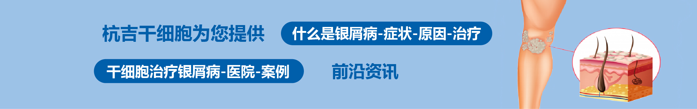 國內外干細胞醫院治療銀屑病的臨床案例