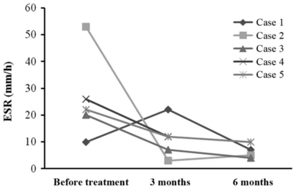 每位患者治療前后的 ESR。3 位患者的 ESR 明顯下降。ESR，紅細胞沉降率。