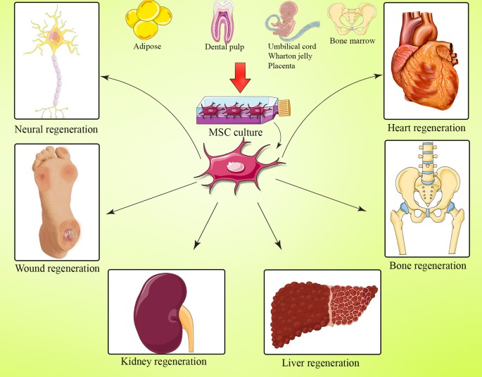 間充質干細胞(MSC) 是一種多能細胞，可分化為基質譜系細胞。間充質干細胞(MSC) 是骨髓 (BM-MSC)、脂肪組織、肝臟、羊水、胚胎胎盤、臍帶血和其他組織中的一組非造血細胞。骨髓間充質干細胞能夠抑制與GVHD病理生理學有關的大多數免疫細胞的激活和功能。