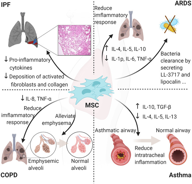 間充質干細胞在特發性肺纖維化 (IPF)、急性呼吸窘迫綜合征 (ARDS)、慢性阻塞性肺疾病 (COPD) 和哮喘中的主要作用