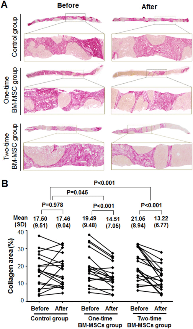 膠原蛋白面積的定量組織學分析。