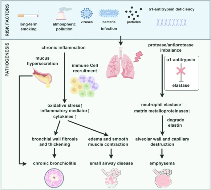 圖1:慢性阻塞性肺疾病的風(fēng)險(xiǎn)因素和發(fā)病機(jī)制。 圖1:慢性阻塞性肺疾病的風(fēng)險(xiǎn)因素和發(fā)病機(jī)制。