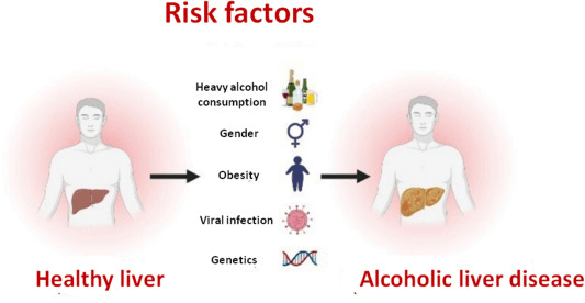 酒精性肝病風險因素 酒精性肝病風險因素