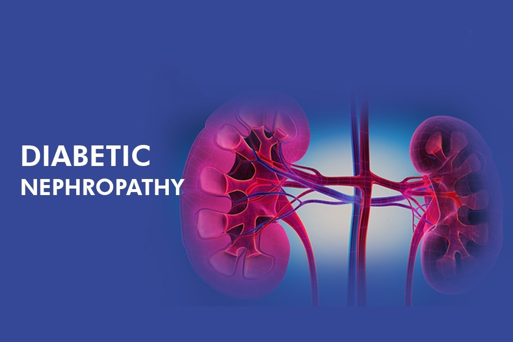 干細胞治療糖尿病腎病患者16例，能夠有效控制血糖，改善腎功能