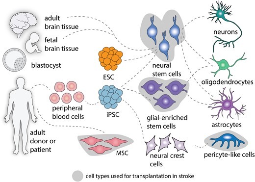 圖2:中風(fēng)后細(xì)胞治療的細(xì)胞類型。 圖2:中風(fēng)后細(xì)胞治療的細(xì)胞類型。
