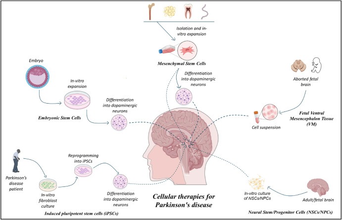 圖1：帕金森病的細胞療法：胚胎干細胞 (ESC)、誘導性多能干細胞 (iPSC)、間充質干細胞 (MSC)、神經干細胞/祖細胞 (NSC/NPS) 是帕金森病的新興候選藥物。