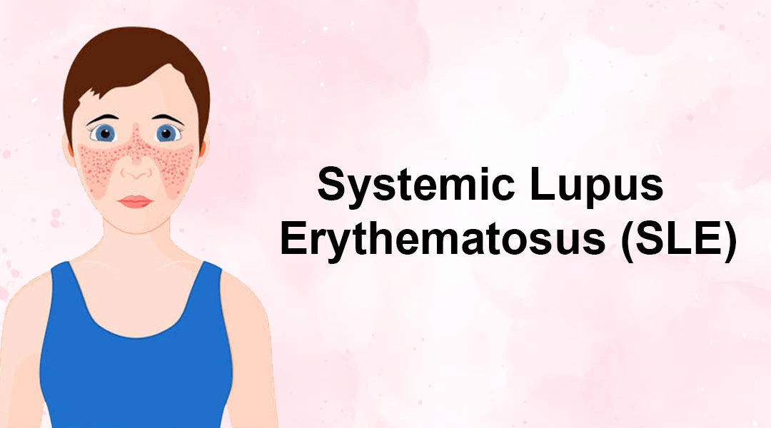 間充質干細胞治療系統性紅斑狼瘡3大作用機制，你都了解嗎？